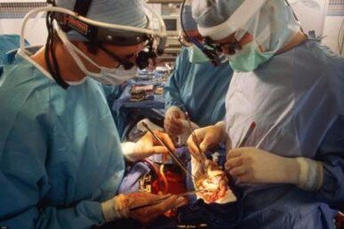 Transplantimi i muskujve mikrokirurgjikale